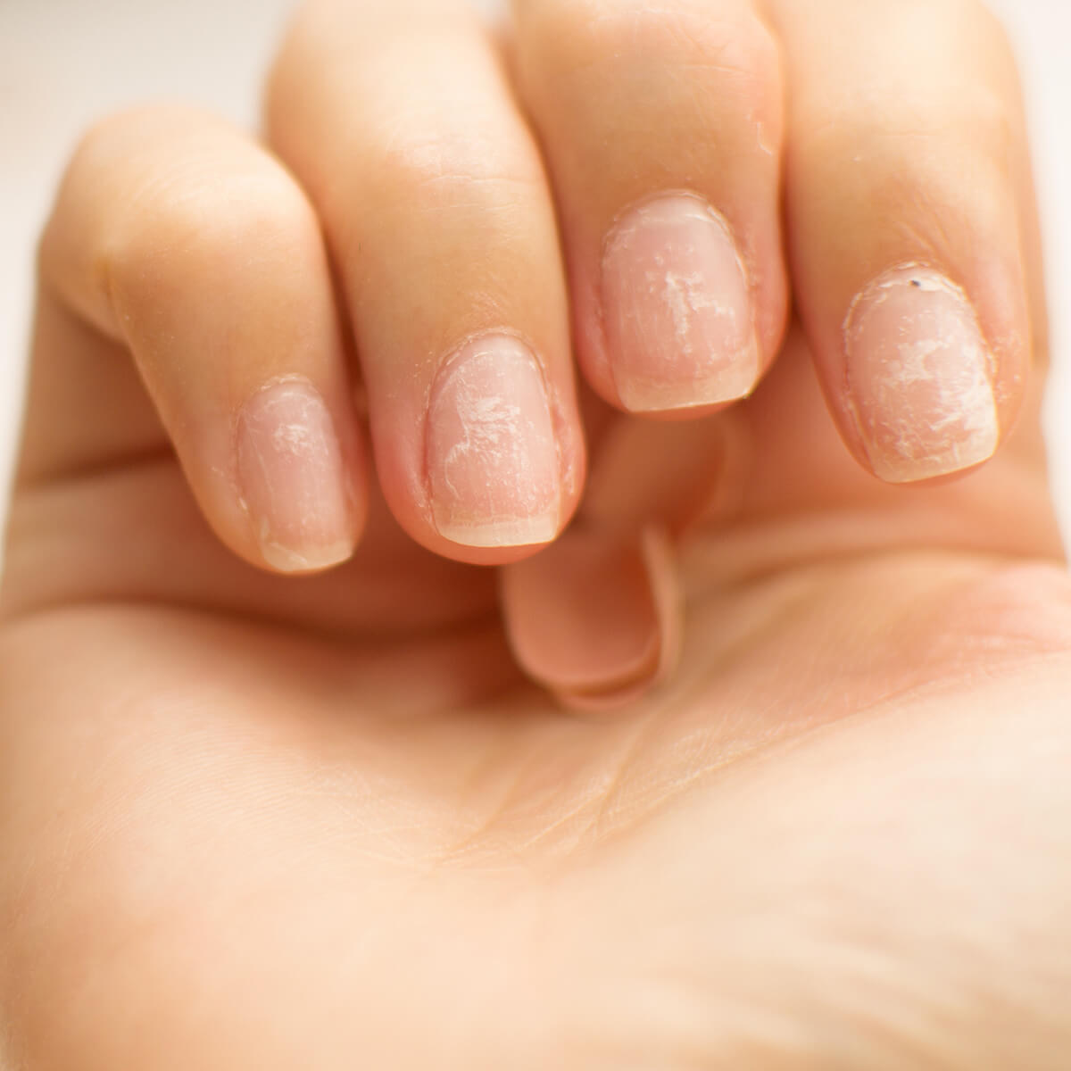 How to Strengthen Weak, Brittle Nails – 100% PURE